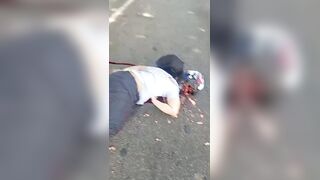 They Say Helmets Save Lives ...