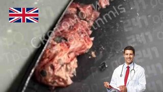 British doctor's brains painting the car.
