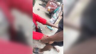 Huge Stone to the Head Leaves Woman Unconscious in Street Confrontation