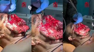 Russian vagina-face.