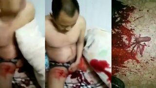 wife cuts off husband's penis