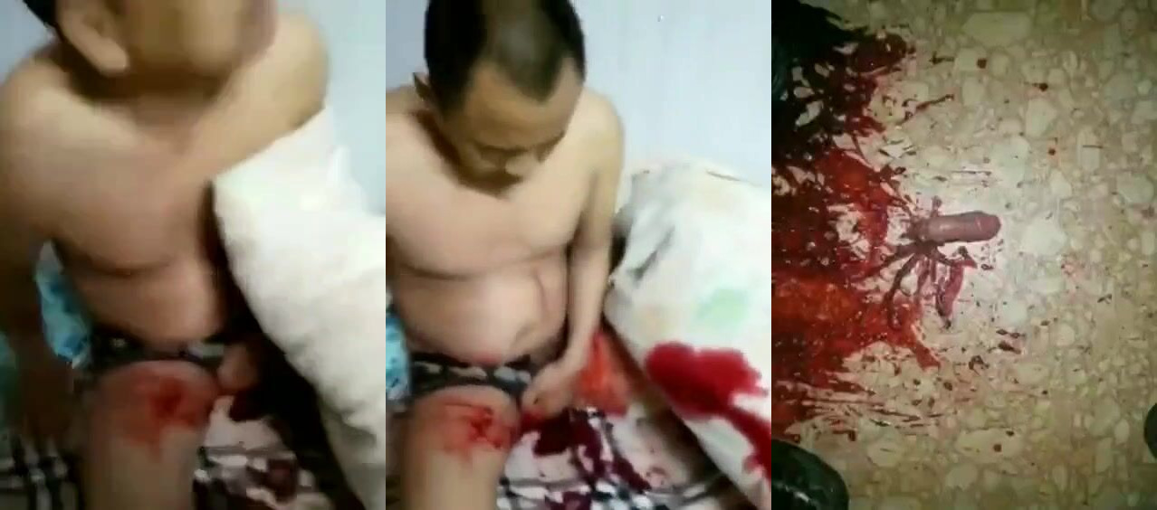 wife cuts off husband's penis