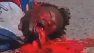 Man Vomits Own Intestines After Being Run Ovewr By Truck