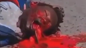 Man Vomits Own Intestines After Being Run Ovewr By Truck