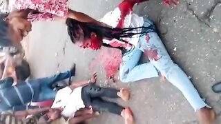 Woman Left With Huge Hole In Her Face