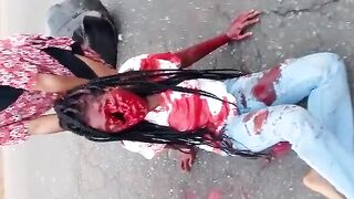 Woman Left With Huge Hole In Her Face