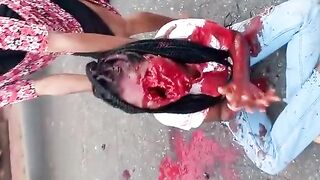 Woman Left With Huge Hole In Her Face