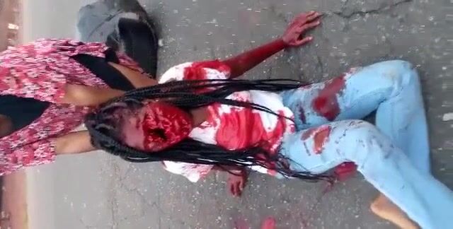 Classic: Woman Left With Huge Hole In Her Face