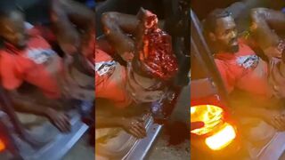 Jamaican Dude Got His Leg Fucked Up