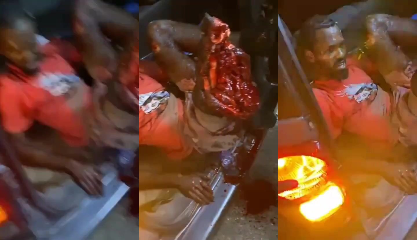 Jamaican Dude Got His Leg Fucked Up