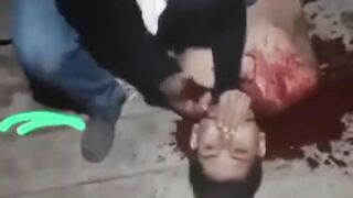 COMPILATION OF THROAT-SLITTINGS 2