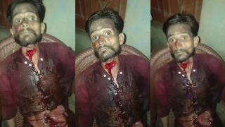 Man In Shock After Attempting To Slit Own Throat During Family Dispute