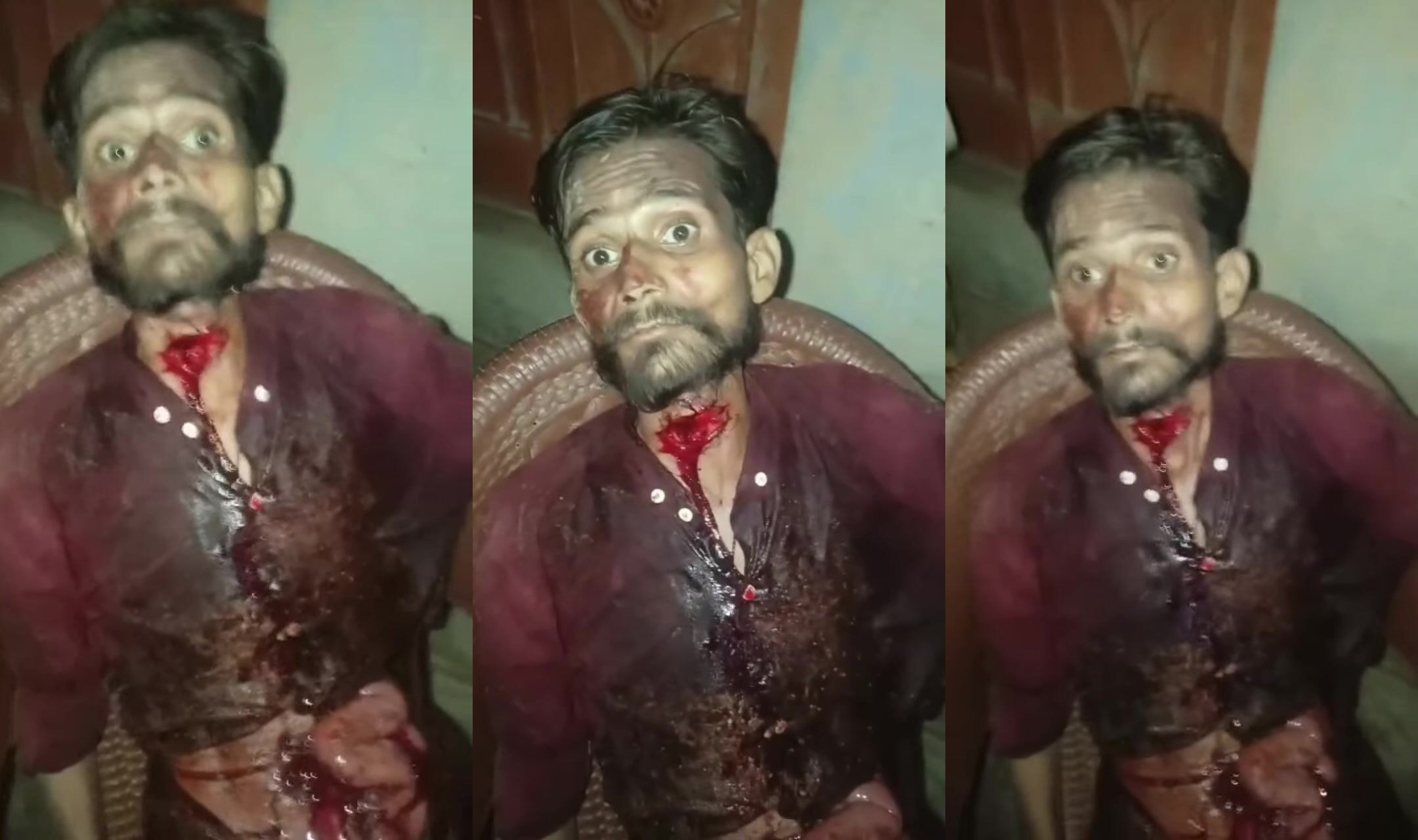 Man In Shock After Attempting To Slit Own Throat During Family Dispute