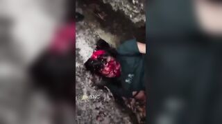 Motorcyclist SCALPED After Traffic Accident