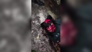 Motorcyclist SCALPED After Traffic Accident