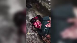 Motorcyclist SCALPED After Traffic Accident