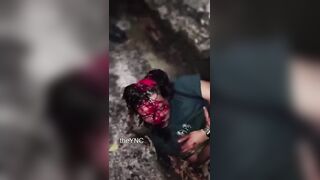 Motorcyclist SCALPED After Traffic Accident