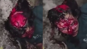 Motorcyclist SCALPED After Traffic Accident