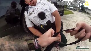 Two Cops, Suspect Shot Following OIS In Florida