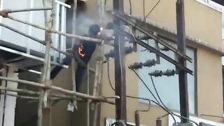 Electrician is electrocuted and burned completely to the bone!