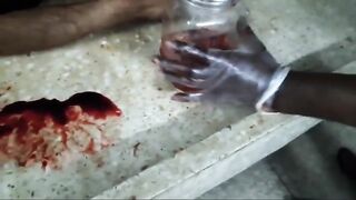 Full autopsy video
