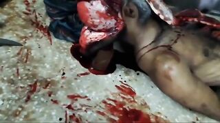 Full autopsy video