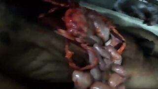 Full autopsy video