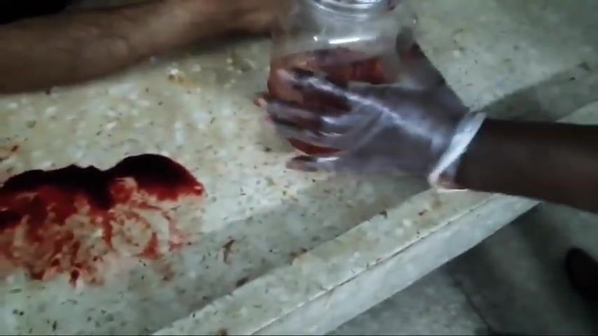Full autopsy video