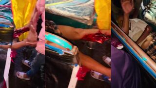Broken femur in tuktuk accident