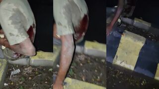 Beat and stabbed, intestines out