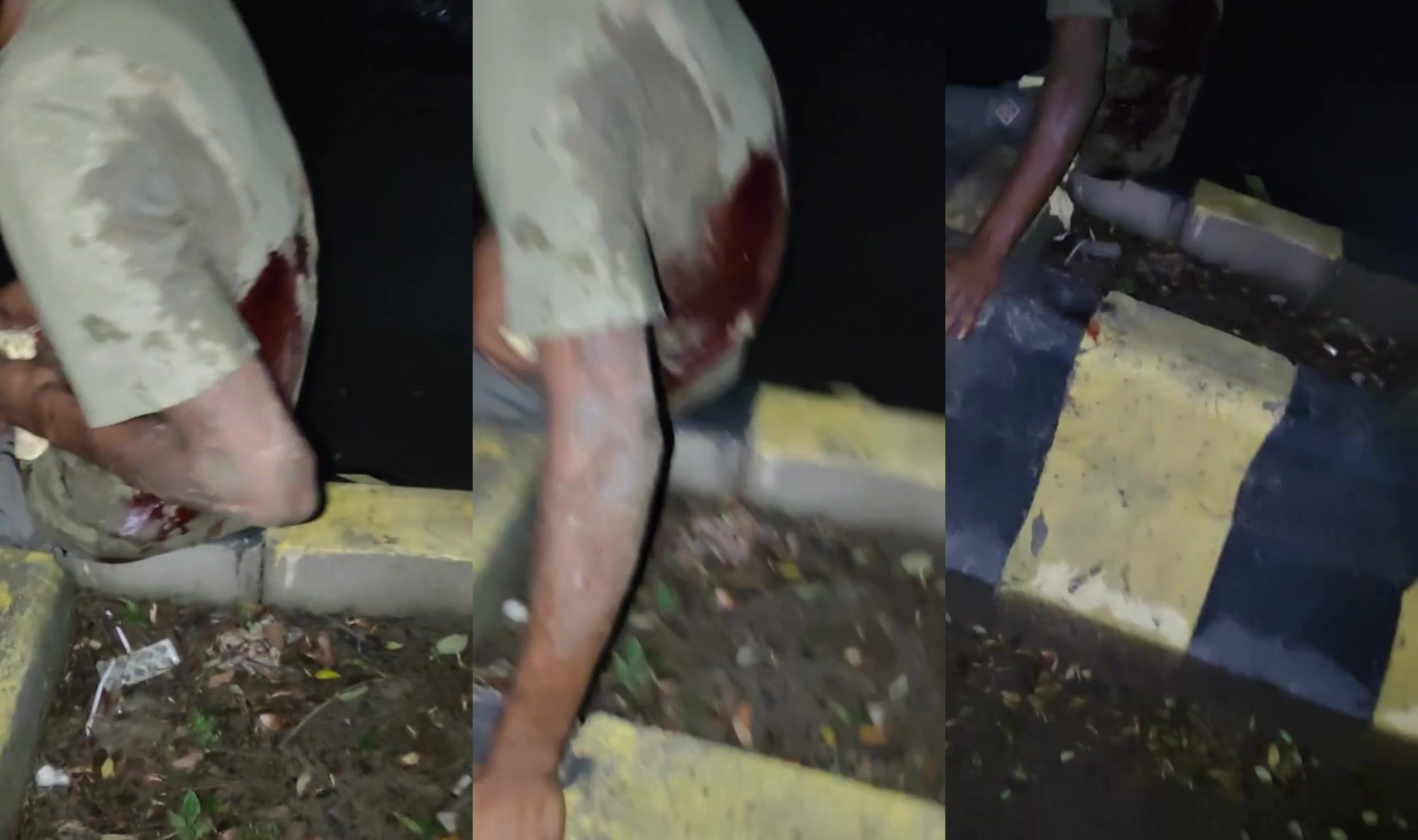 Beat and stabbed, intestines out