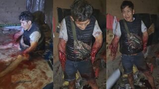 TERRIBLE: Man Lost Both Arms, Woman Killed After Explosion In Peru