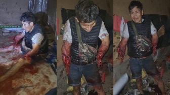 TERRIBLE: Man Lost Both Arms, Woman Killed After Explosion In Peru