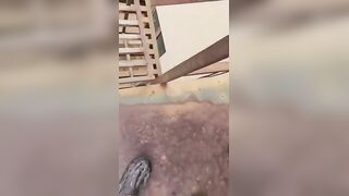 Man Suffers Fractures After Falling Nearly 40 Feet During Zipline Ride