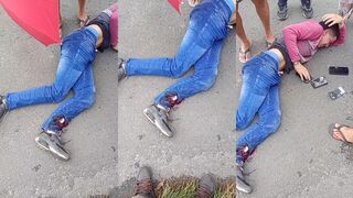 Motorcyclist`s Bone Exposed After Fender Bender In Brazil