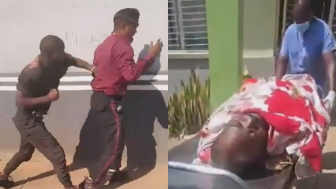 Security Guard Hospitalized After Getting Beaten By His Boss In Zambia
