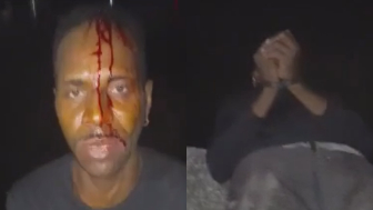 Man With Hands Tied Executed With A Single Shot