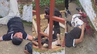 Dogs Maul Trespasser’s Right Foot After He Allegedly Tried to Break Into Property