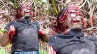 In Congo Soldiers Cut Off Civilan`s Palms And Left Him To Die