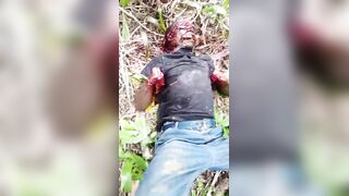 In Congo Soldiers Cut Off Civilan`s Palms And Left Him To Die