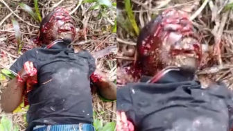 In Congo Soldiers Cut Off Civilan`s Palms And Left Him To Die