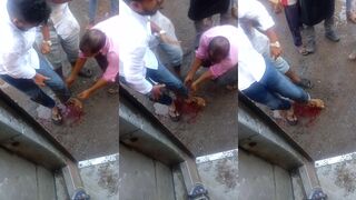 Run over by motorcycle