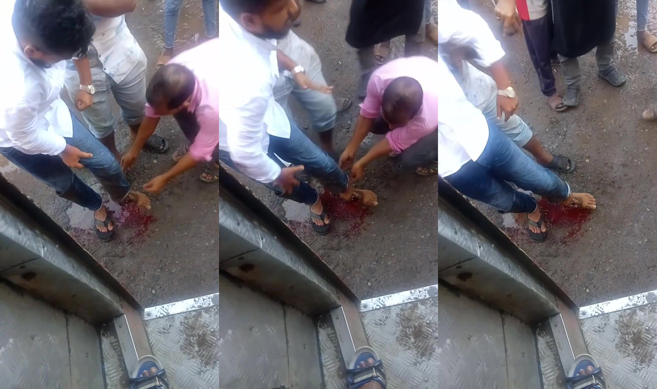 Run over by motorcycle