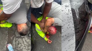 Man beat bloody after stabbing his baby mother