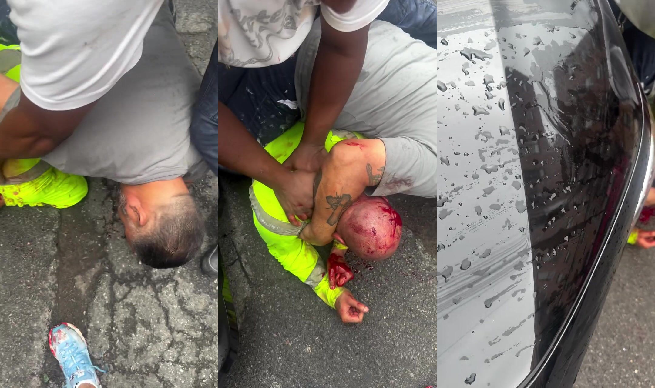 Man beat bloody after stabbing his baby mother