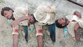 Man hit by train leg mangled