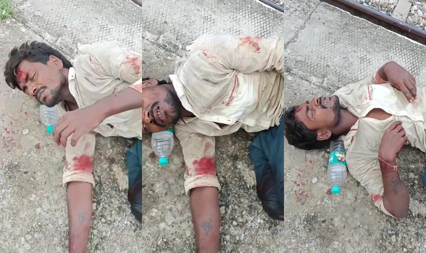 Man hit by train leg mangled