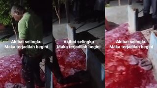 Bleeding out after machete attack