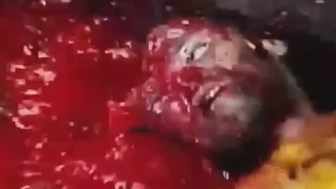Aftermath Of Street Execution Of A Man With Gang Ties