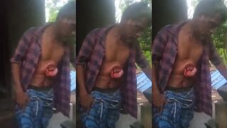 Intestines exposed after elephant attack
